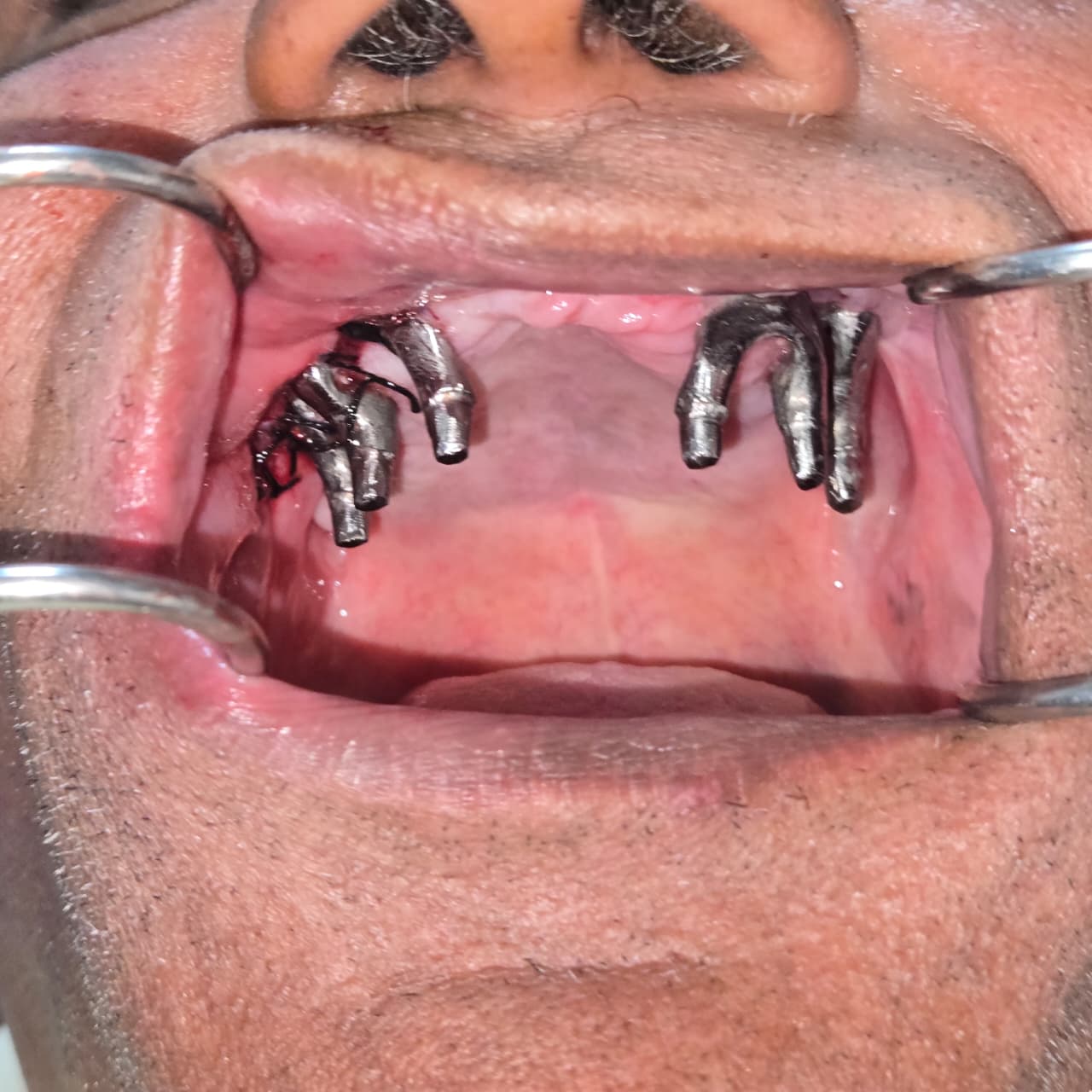 Damaged Smile