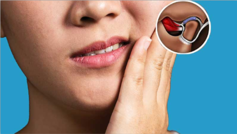 TMJ Pain Management