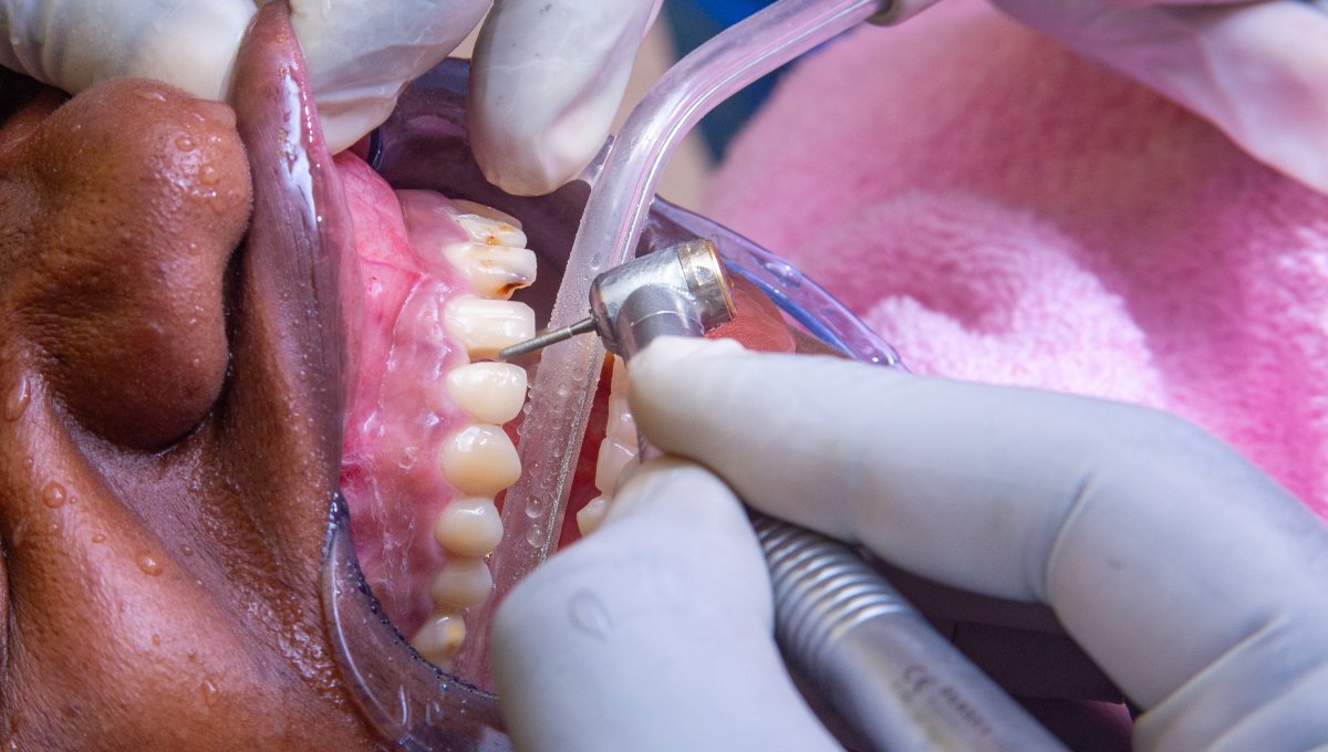 Gum Disease Treatment