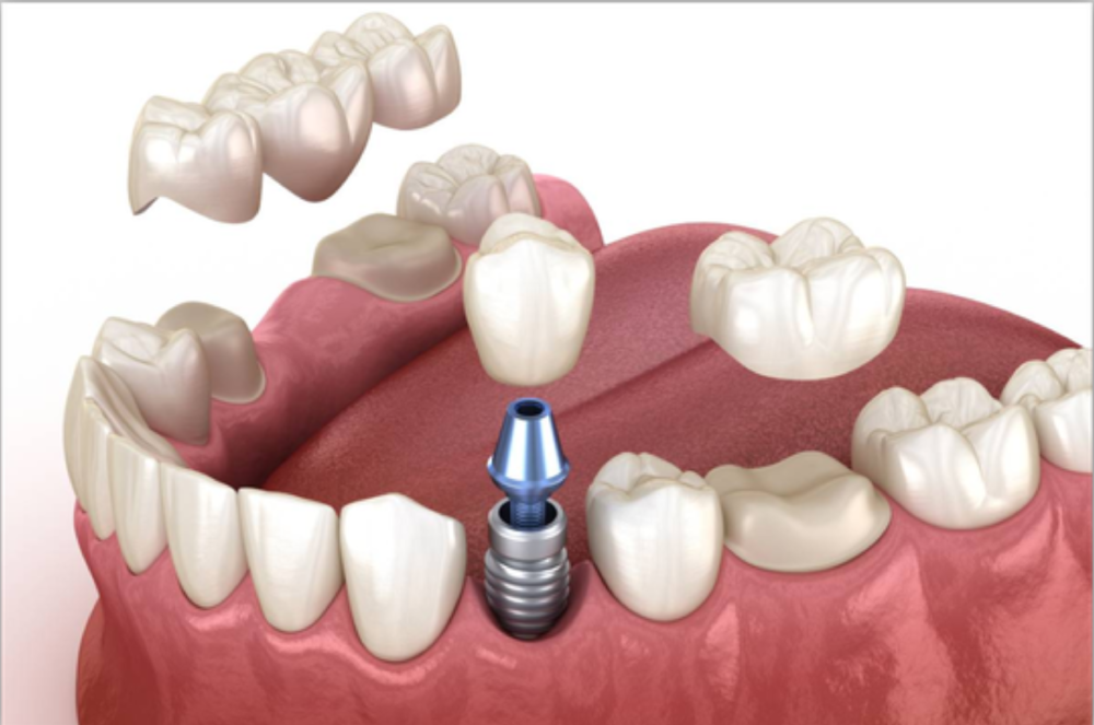 Restorative Dentistry