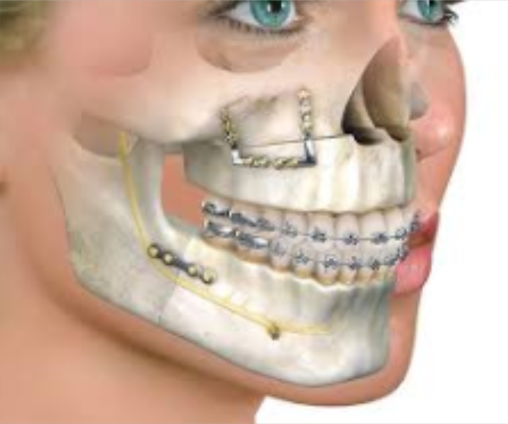 Road Accident Treatment